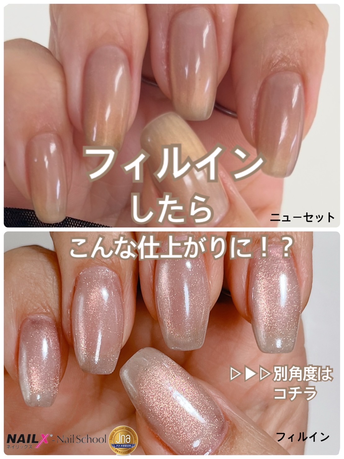 フィルイン&美フォルムセミナー